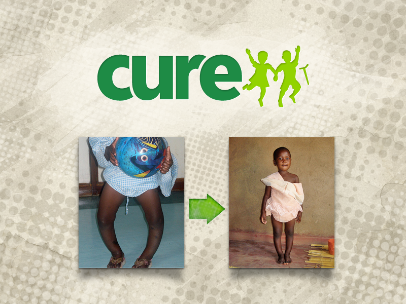 CURE International (logo & patient before and after image)